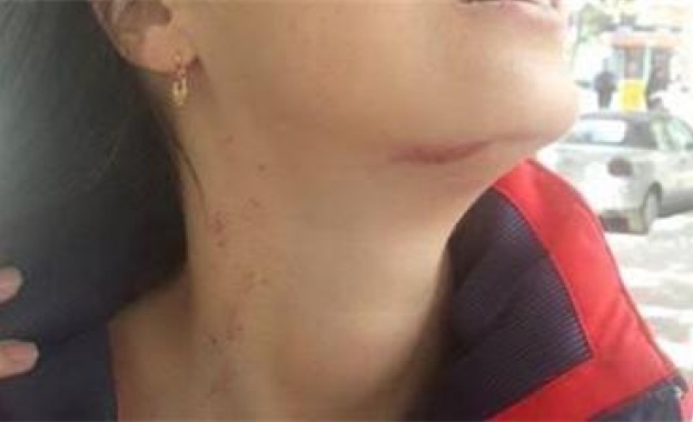 Вижте следите от душене на ограбената и пребита жена от Асеновград