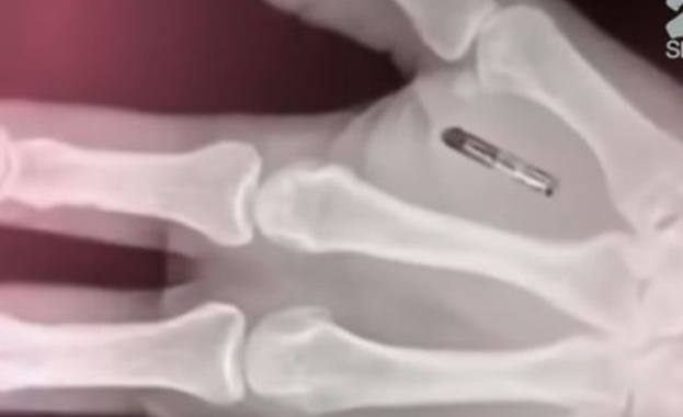 Американец си имплантира безжични чипове в ръцете 
